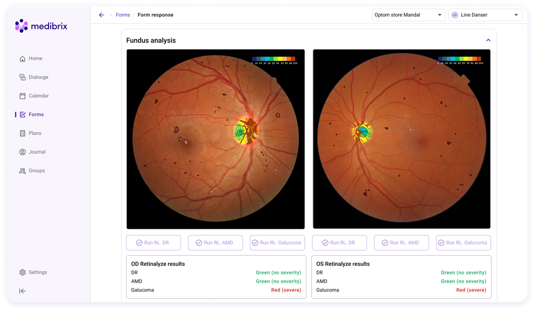RetinaLyze fundus analysis in Medibrix